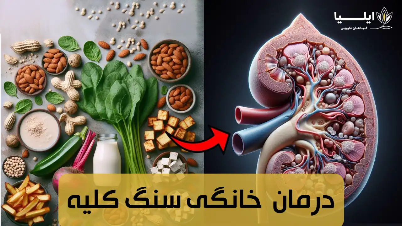 درمان خانگی سنگ کلیه 02 | گیاهان دارویی ایلیا