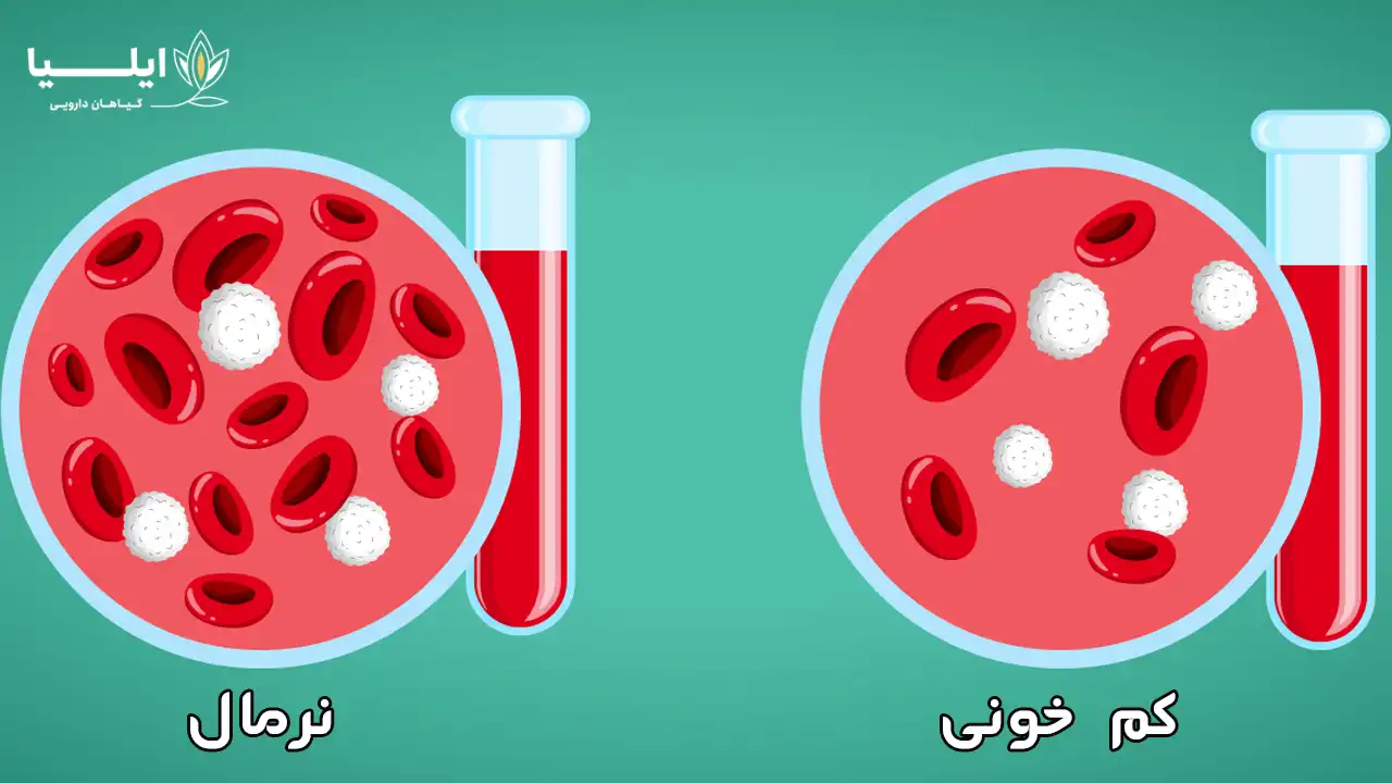 درمان خانگی کم خونی 2 | گیاهان دارویی ایلیا