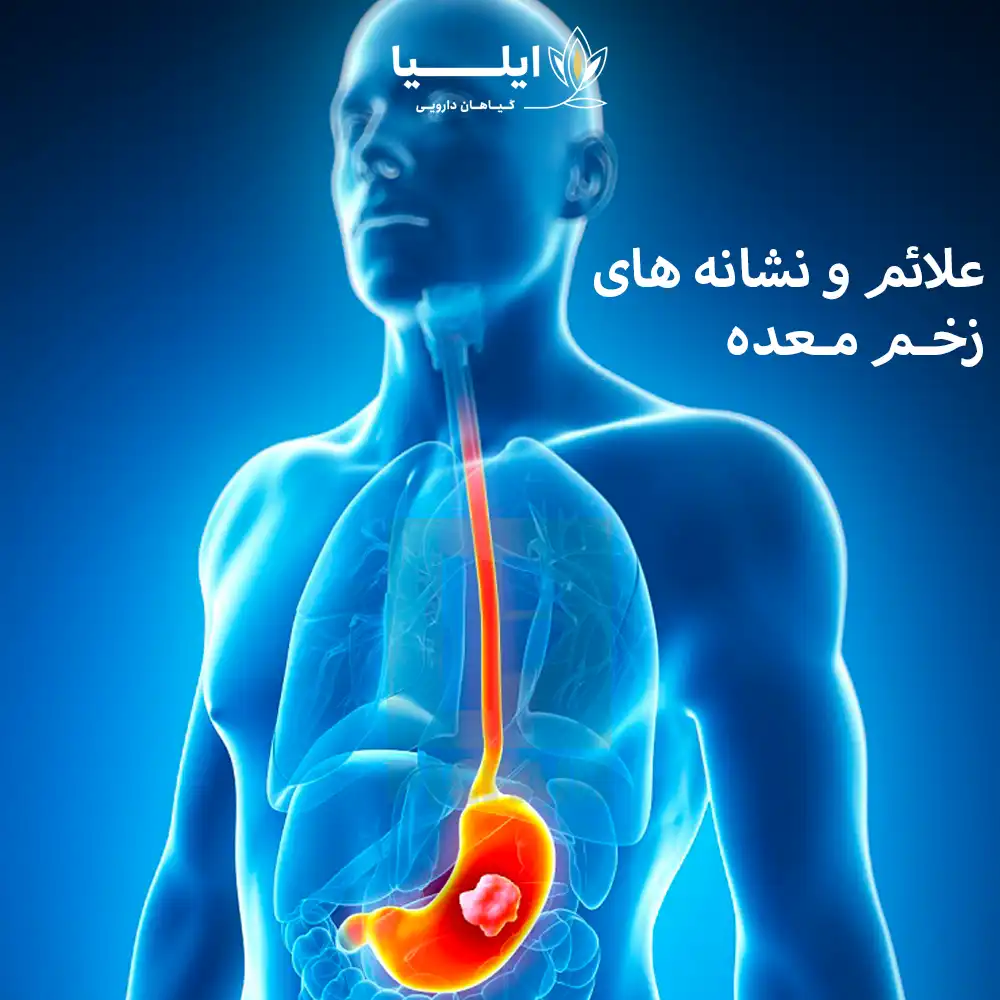 زخم معده چیست 3 | گیاهان دارویی ایلیا