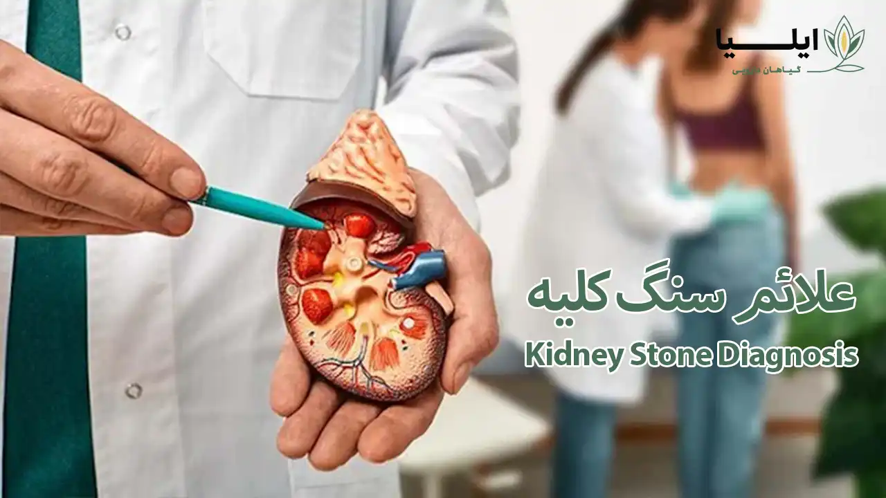 علائم دقیق سنگ کلیه چپ- علائم سنگ کلیه در زنان