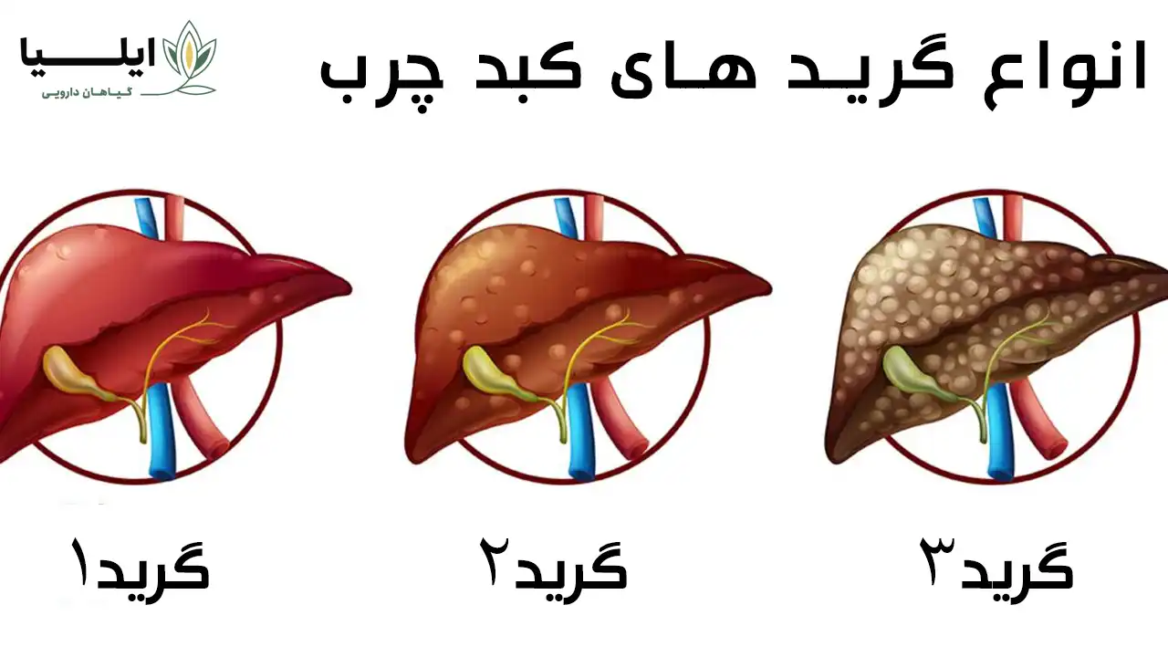 کبد چرب چیست 02 | گیاهان دارویی ایلیا